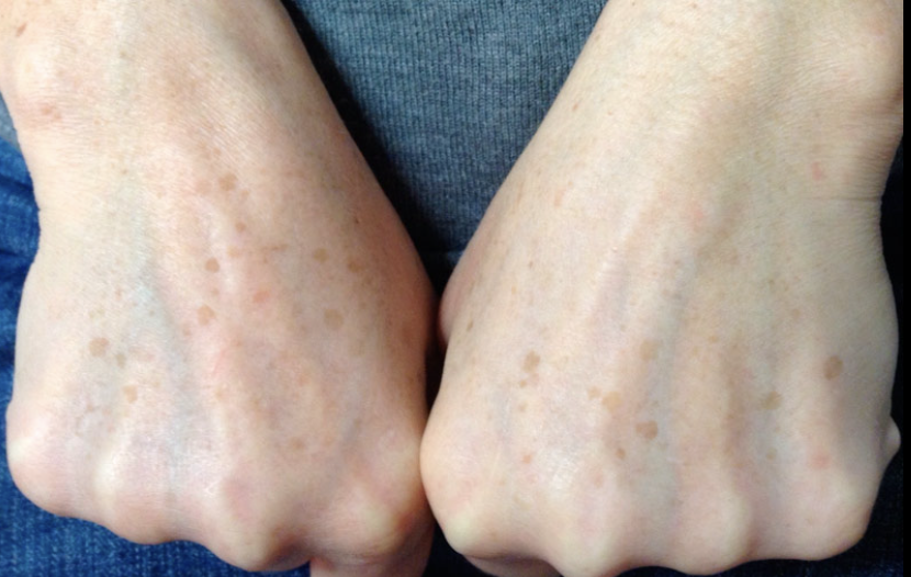 Primer plano macro de una flor en forma de campana de color púrpura intenso con estambres blancos sobre un fondo verde desenfocado.