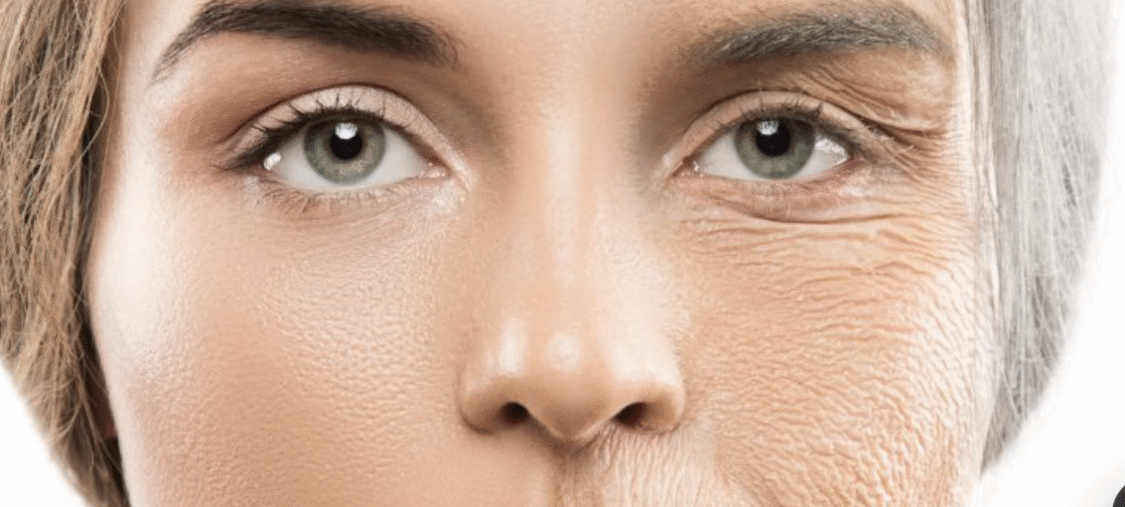 Primer plano del rostro de una mujer dividido a la mitad, mostrando un lado con piel tersa y joven frente al otro con arrugas profundas y signos de envejecimiento.